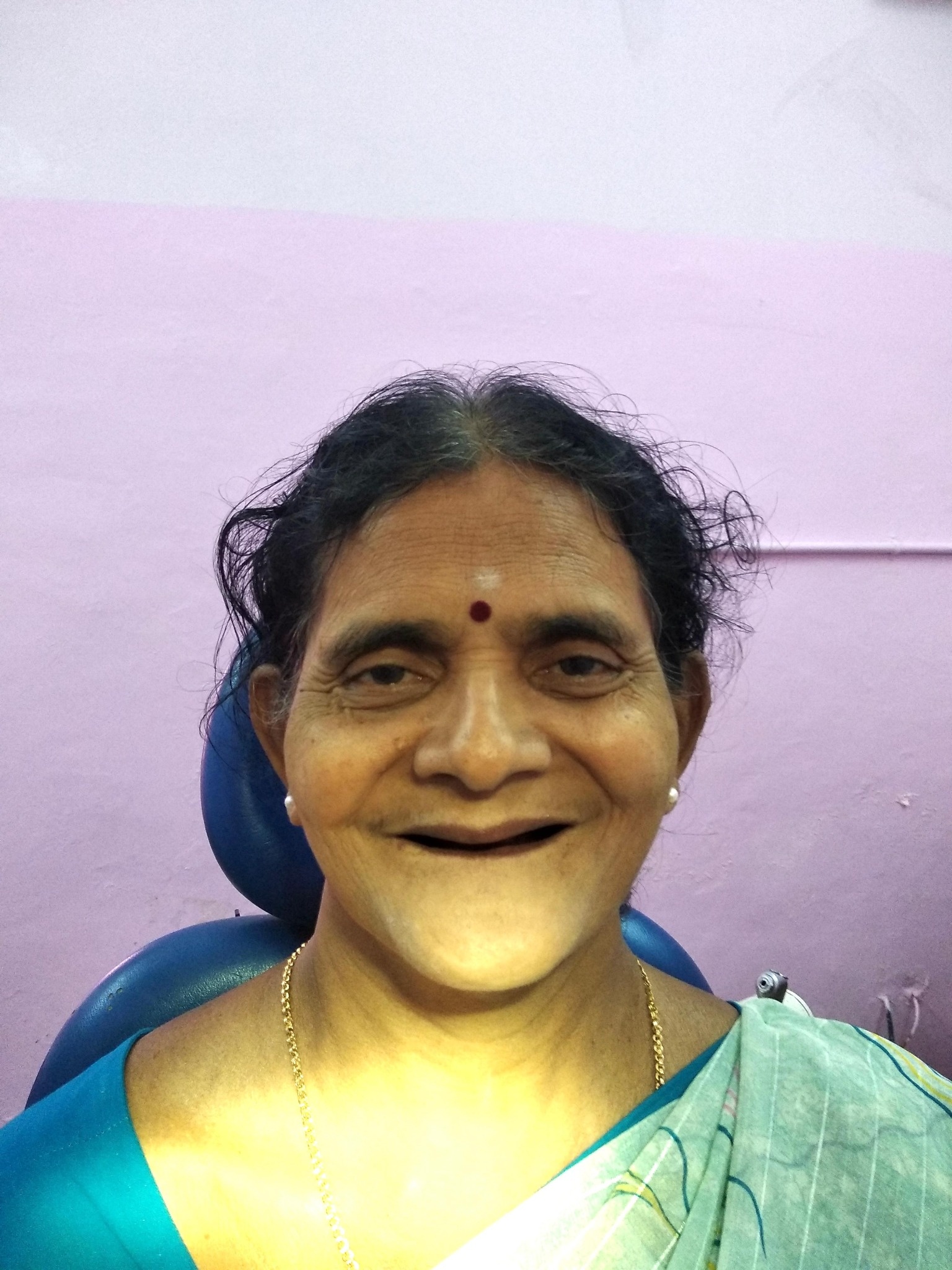 After smile transformation 4